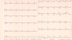 Miniatura obrazu 19 przedstawiająca badanie EKG 