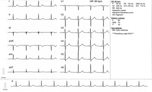 Miniatura obrazu 4 przedstawiająca badanie EKG 