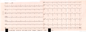 Miniatura obrazu 22 przedstawiająca badanie EKG 