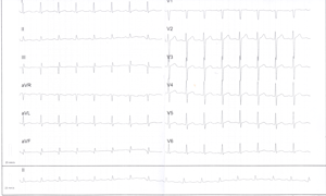 Miniatura obrazu 29 przedstawiająca badanie EKG 