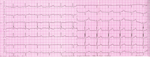 Miniatura obrazu 12 przedstawiająca badanie EKG 