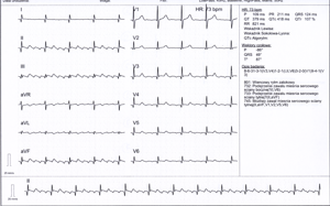 Miniatura obrazu 13 przedstawiająca badanie EKG 