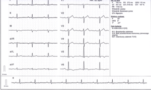 Miniatura obrazu 3 przedstawiająca badanie EKG 